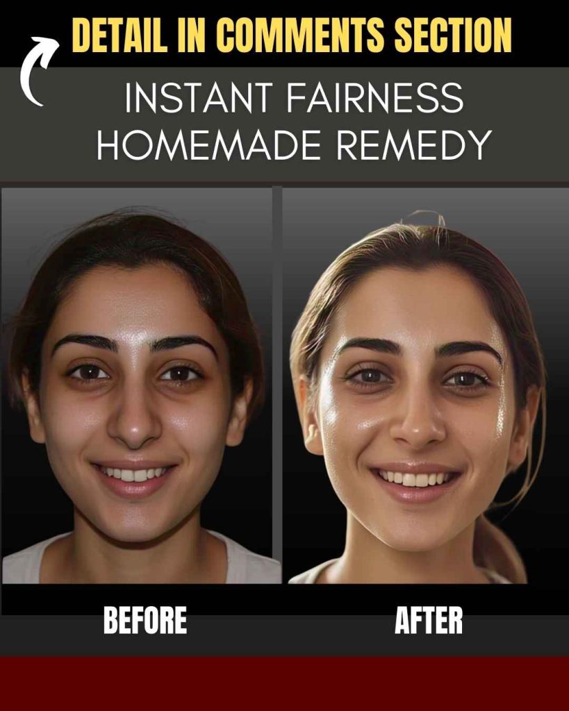 INSTANT FAIRNESS: HOMEMADE REMEDY
