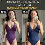 BREAST ENLARGEMENT IDEAL FIGURE