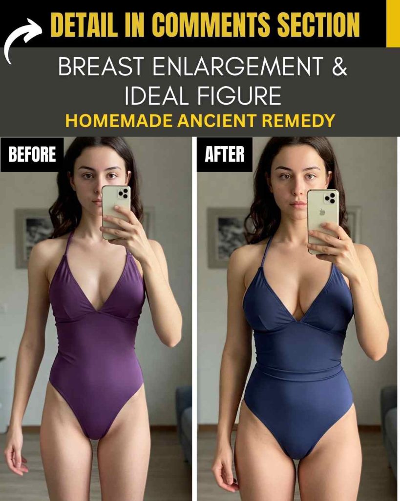 BREAST ENLARGEMENT IDEAL FIGURE