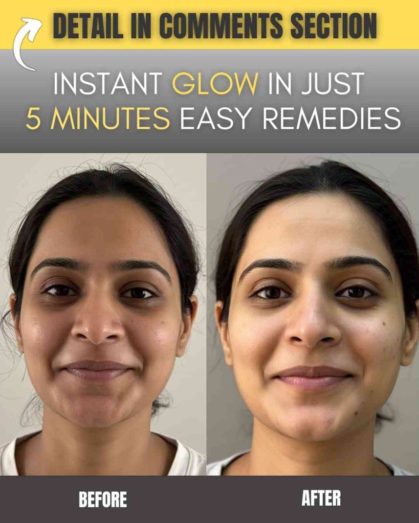 INSTANT GLOW IN JUST 5 MINUTES – EASY REMEDIES