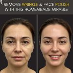Instant Home Remedies to Remove Wrinkles & Polish Your Face A Homemade Miracle