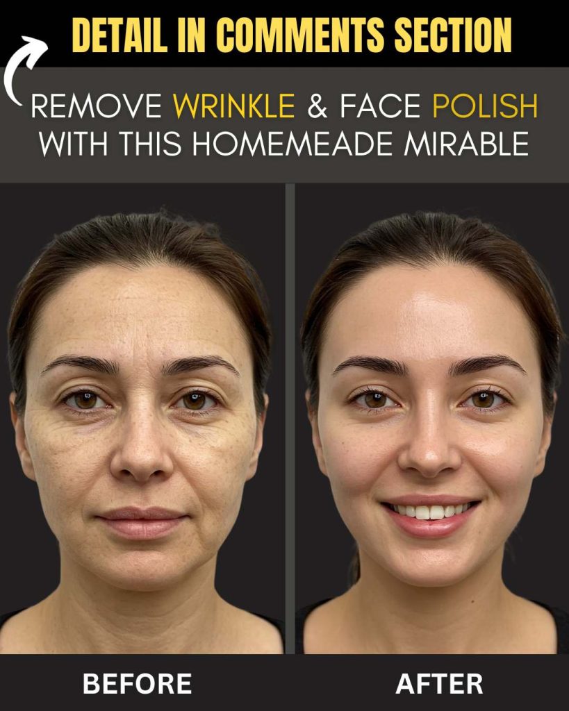 Instant Home Remedies to Remove Wrinkles & Polish Your Face A Homemade Miracle