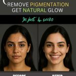 Instant Home Remedies for Removing Pigmentation and Getting a Natural Glow