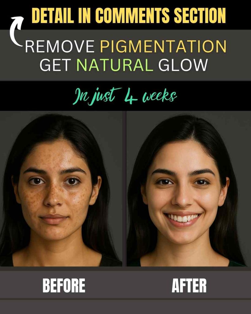 Instant Home Remedies for Removing Pigmentation and Getting a Natural Glow