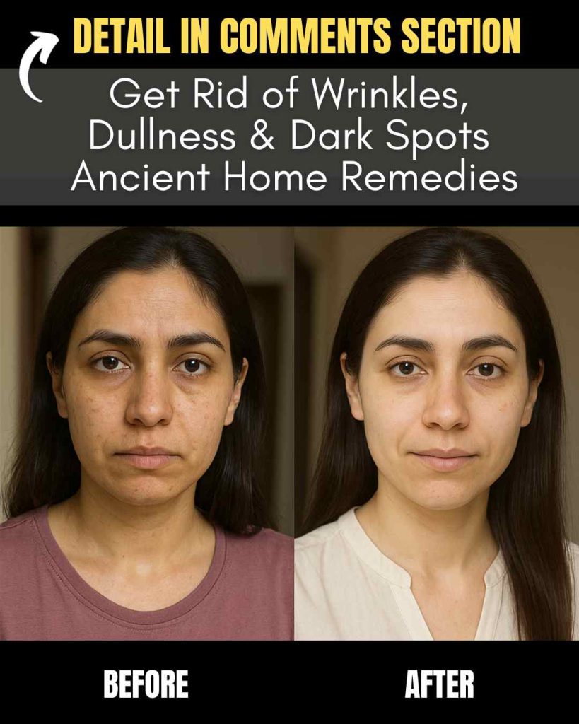 Get Rid of Wrinkles, Dullness, and Dark Spots Using Natural Remedies