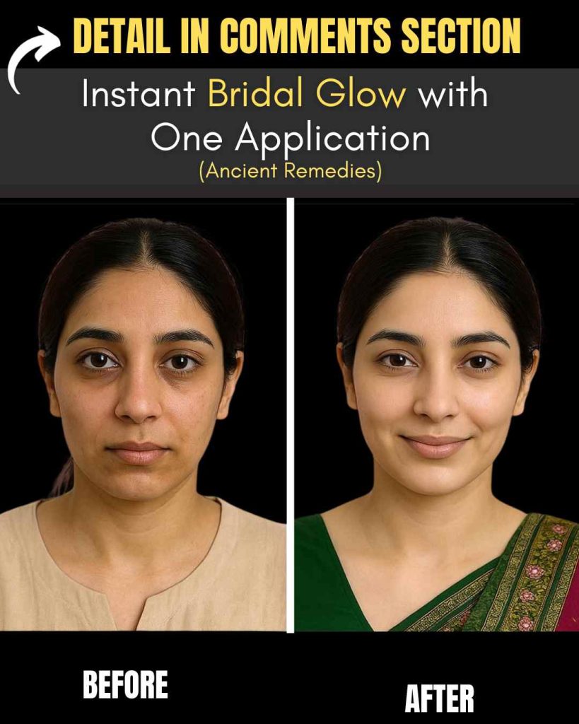 Bridal Glow with Significant Improvement After One Application
