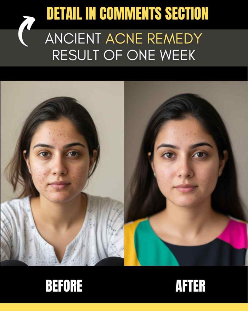 wrinkles Result of One Week