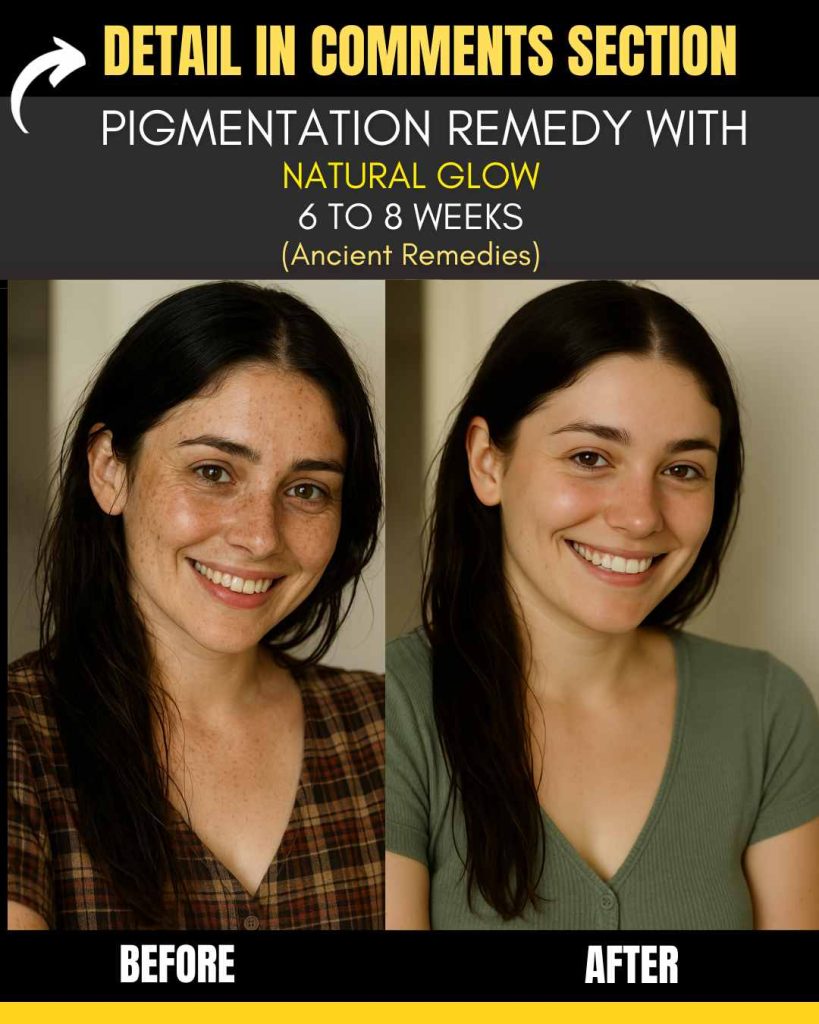 Pigmentation Remedy with Natural Glow (6 to 8 Weeks Result)