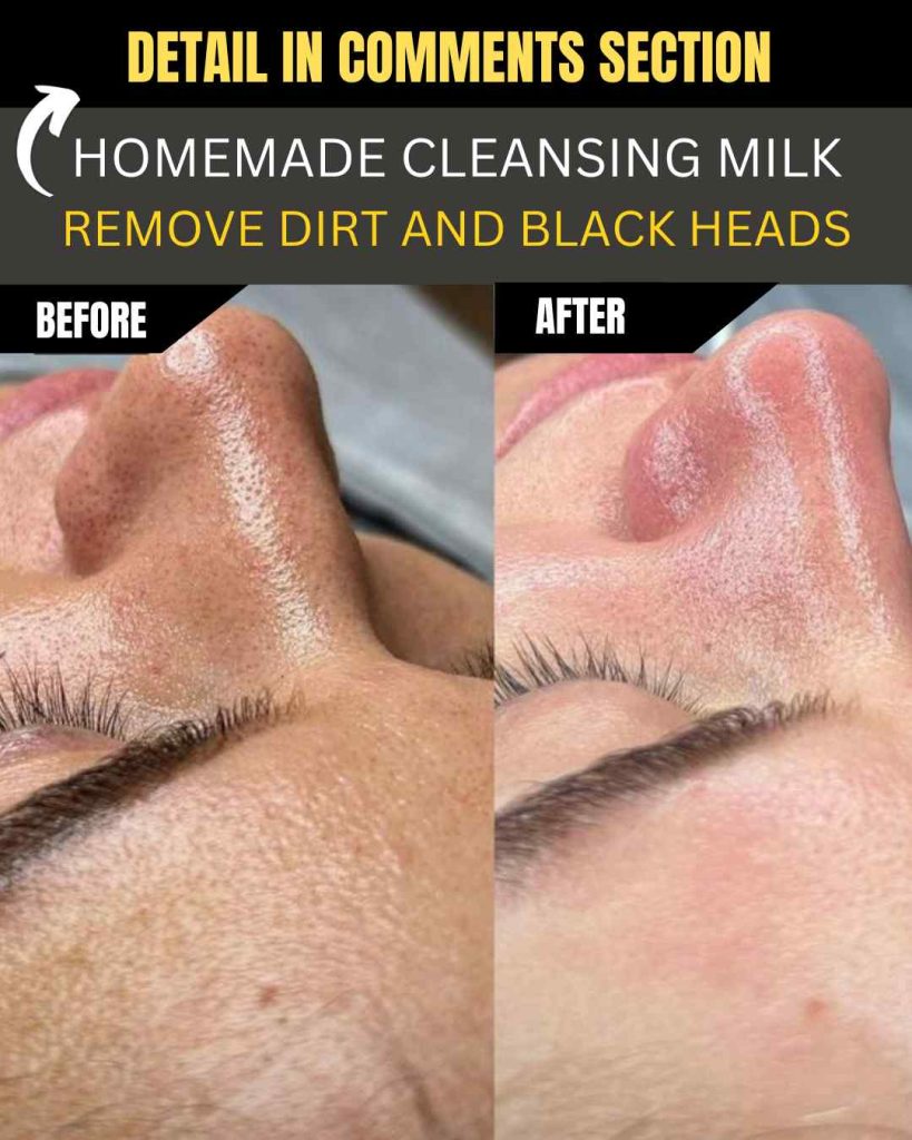 Homemade Cleansing Milk to Remove Dirt and Blackheads Naturally