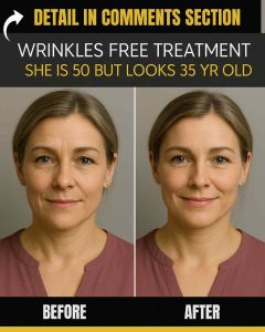WRINKLES FREE TREATMENT SHE IS 50 BUT LOOKS 35 YEARS OLD