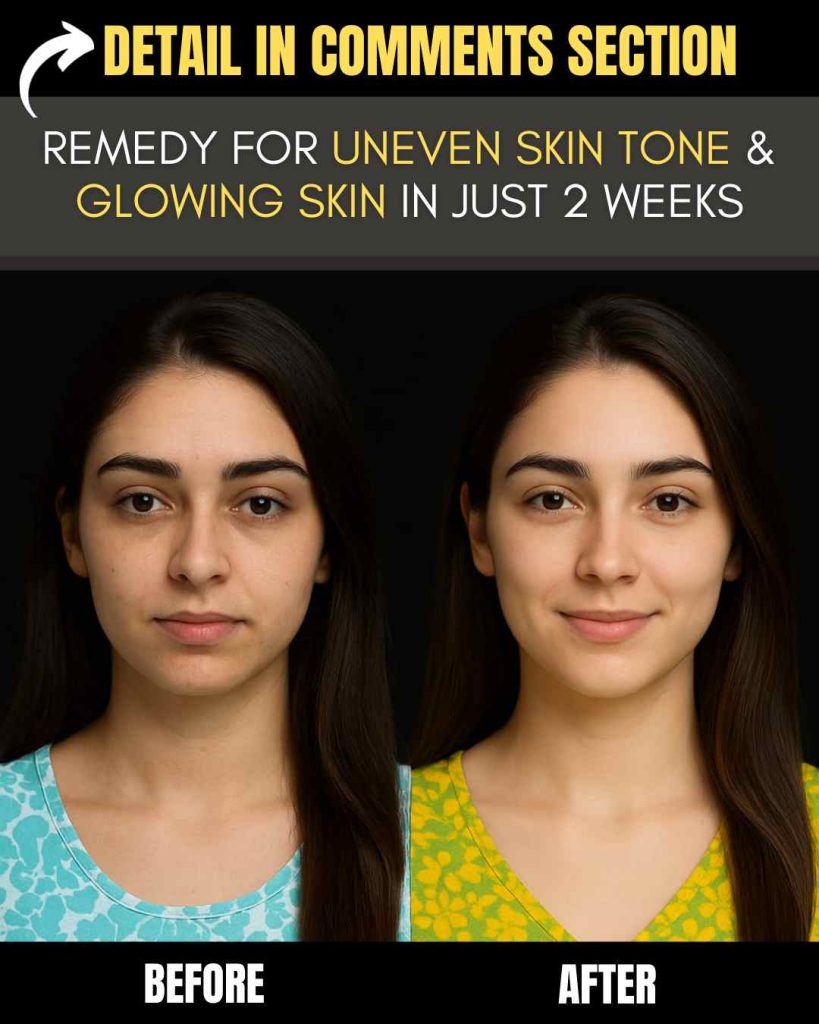 REMEDY FOR UNEVEN SKIN TONE & GLOWING SKIN IN JUST 2 WEEKS