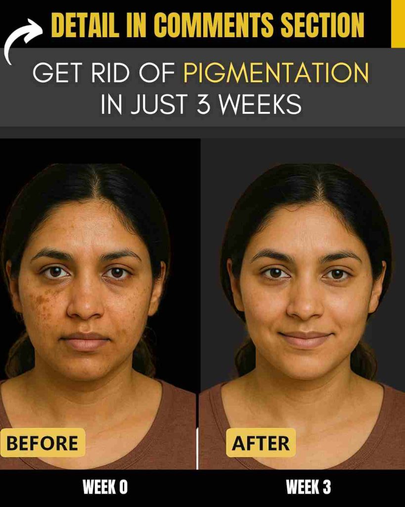 Home Remedies to Get Rid of Pigmentation in Just 3 Weeks