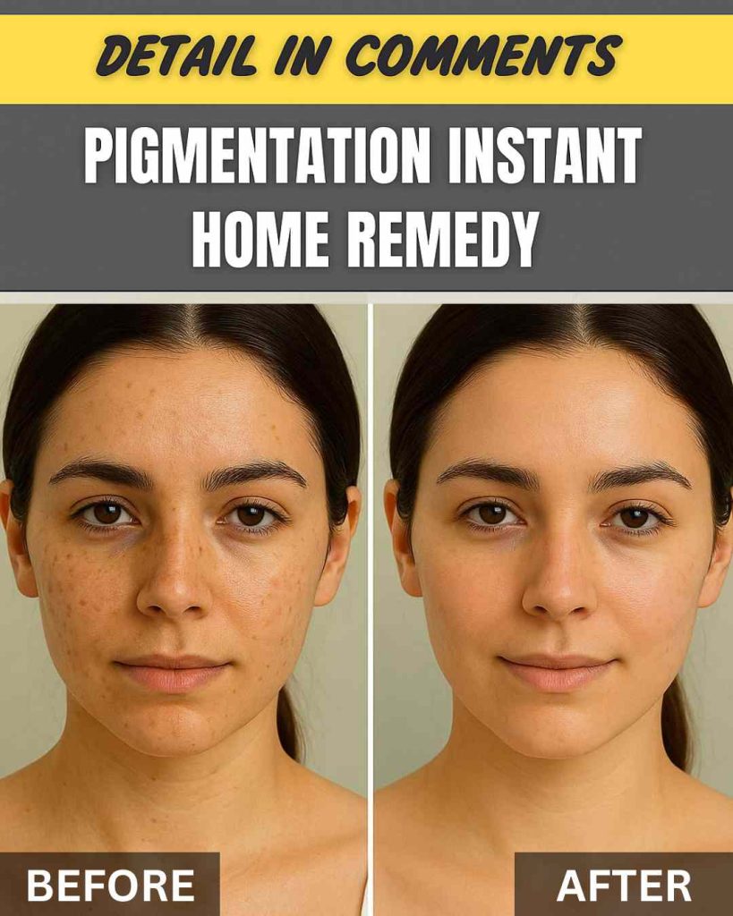 Instant Home Remedies for Pigmentation in Just 7 Days