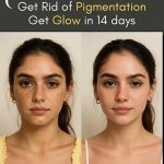 Get Rid of Pigmentation and Get Glow in 14 Days – Effective Home Remedies Based on Skin Type