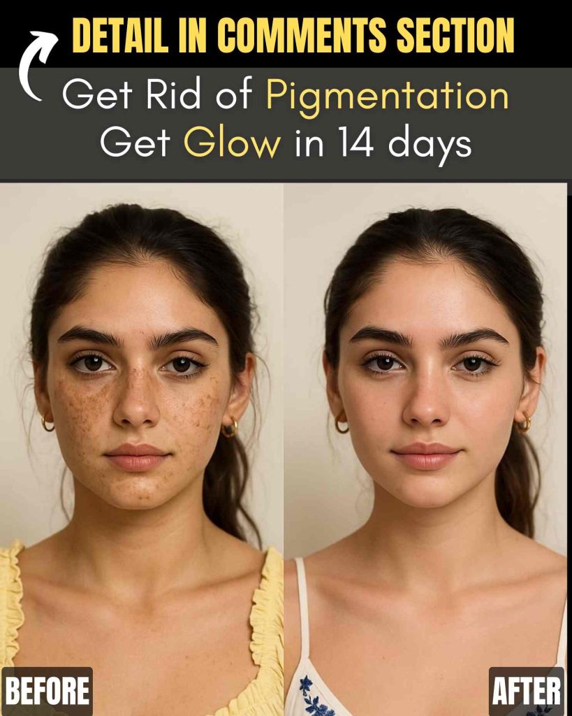 Get Rid of Pigmentation and Get Glow in 14 Days – Effective Home Remedies Based on Skin Type