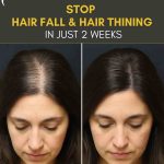 STOP HAIR FALL AND HAIR THINNING IN JUST 2 WEEKS