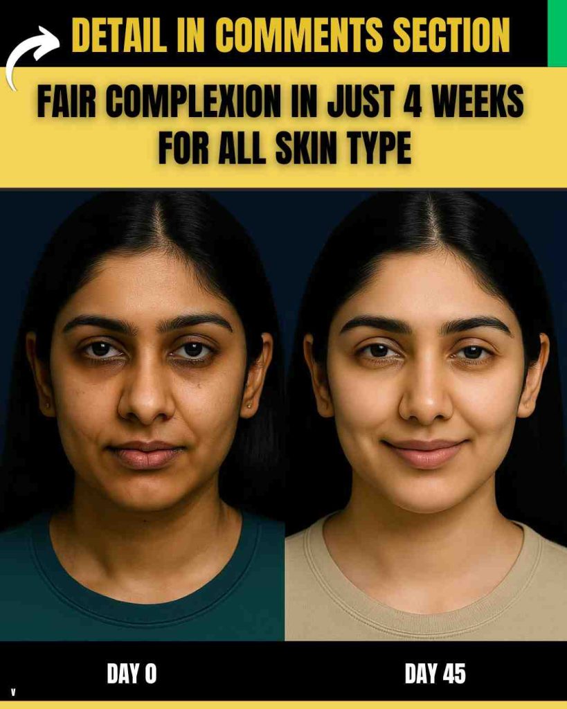FAIR COMPLEXION IN JUST 4 WEEKS FOR ALL SKIN TYPES – NATURAL REMEDIES + FULL DIET PLAN