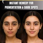 Instant Remedy for Pigmentation & Dark Spots