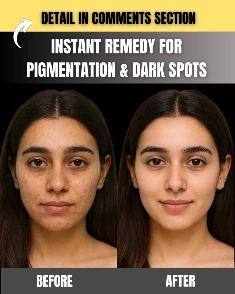 Instant Remedy for Pigmentation & Dark Spots