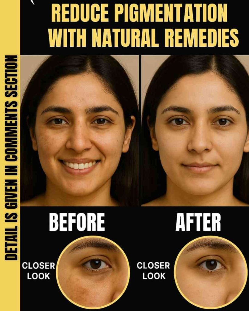 REDUCE PIGMENTATION WITH NATURAL REMEDIES