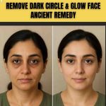 REMOVE DARK CIRCLE & GLOW FACE – ANCIENT REMEDY THAT WORKS