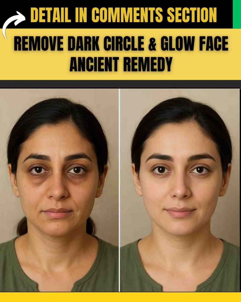 REMOVE DARK CIRCLE & GLOW FACE – ANCIENT REMEDY THAT WORKS