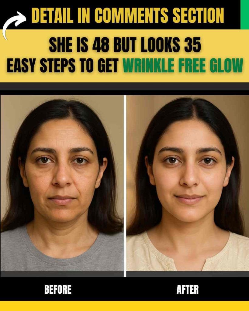 She Is 48 but Looks 35 – Easy Steps to Get Wrinkle-Free Glow Naturally