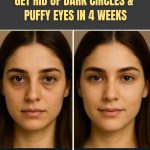 GET RID OF DARK CIRCLES & PUFFY EYES IN 4 WEEKS