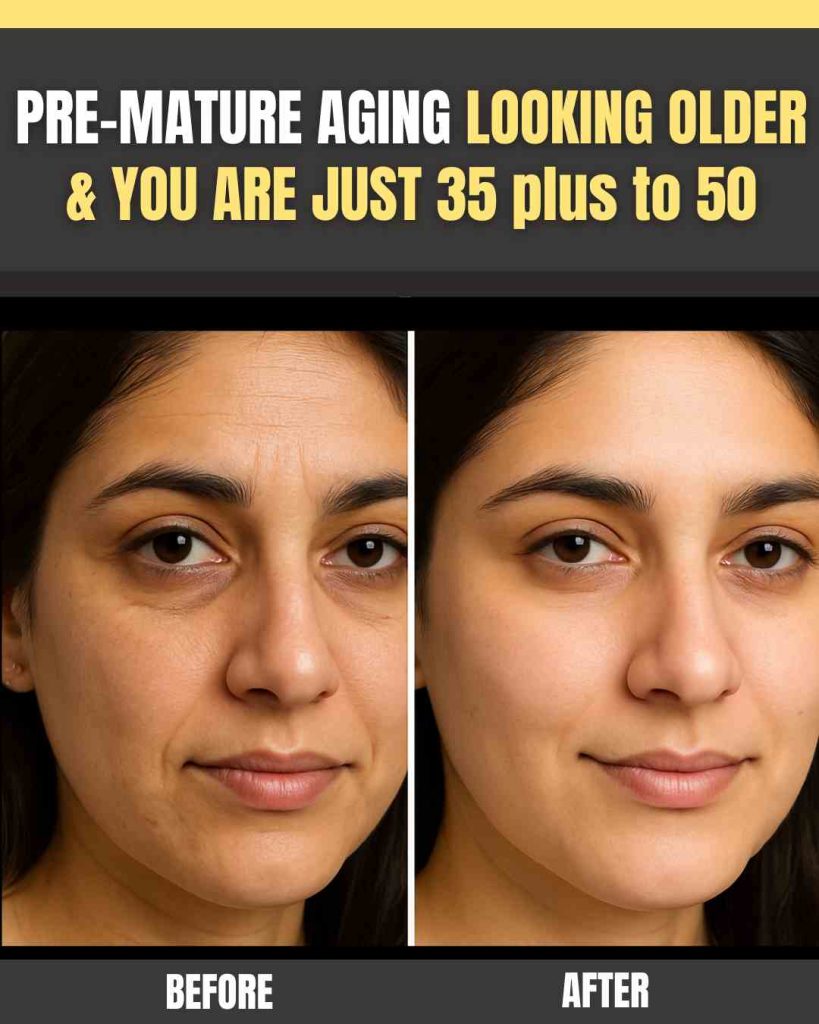 PRE-MATURE AGING: LOOKING OLDER BUT YOU’RE JUST 35 TO 50? REVERSE IT NATURALLY WITH REMEDIES, DIET & EXERCISE