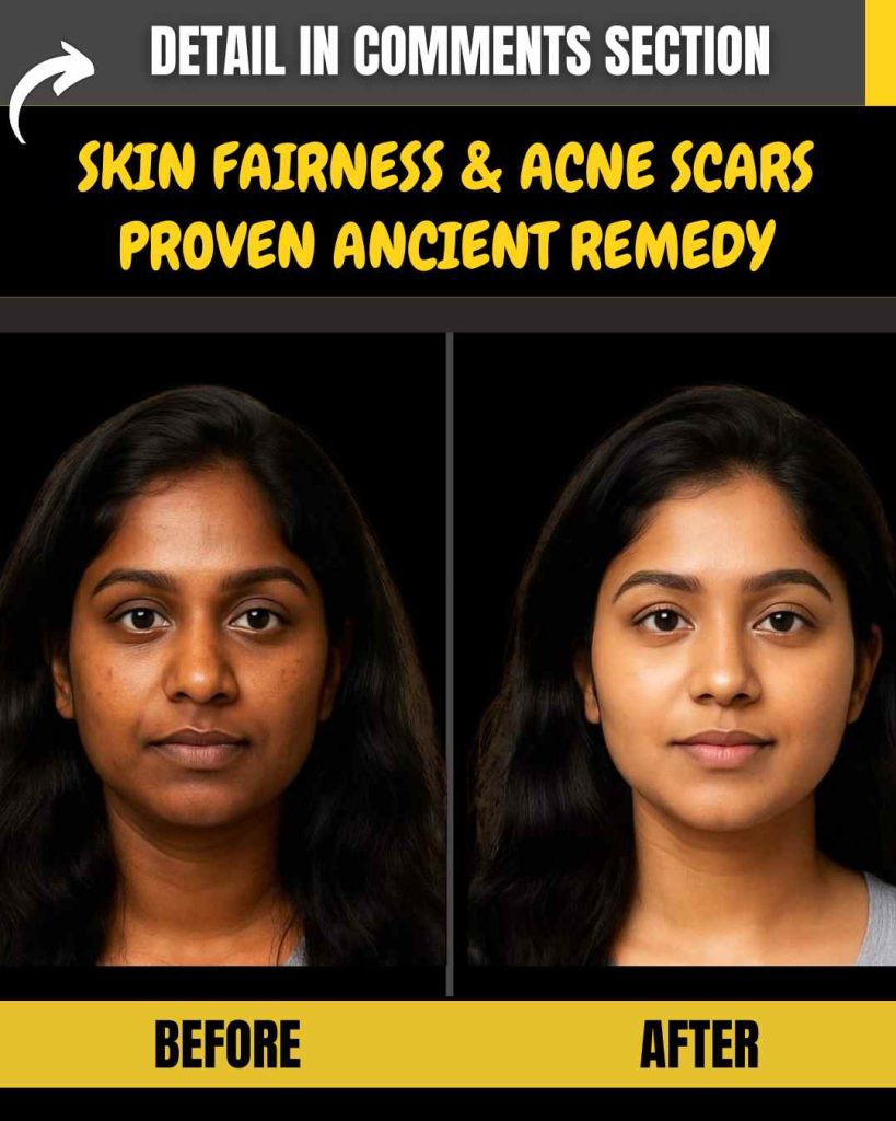 Skin Fairness & Acne Scars: Proven Ancient Remedy by Skin Type