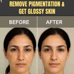 REMOVE PIGMENTATION & GET GLOSSY SKIN
