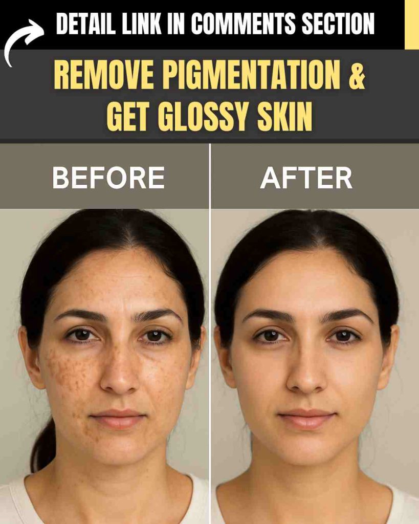 REMOVE PIGMENTATION & GET GLOSSY SKIN