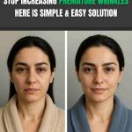 STOP INCREASING PREMATURE WRINKLES: HERE IS A SIMPLE & EASY SOLUTION WITH DETAILED DIET PLAN