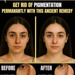 GET RID OF PIGMENTATION PERMANENTLY WITH THIS ANCIENT REMEDY (BY SKIN TYPE)