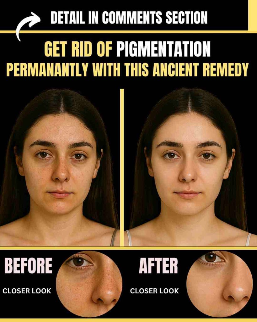 GET RID OF PIGMENTATION PERMANENTLY WITH THIS ANCIENT REMEDY (BY SKIN TYPE)