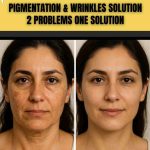 Pigmentation and wrinkles are two of the most stubborn skin issues that affect both appearance and self-confidence. While pigmentation leads to uneven skin tone and dark patches, wrinkles are signs of aging that result from loss of collagen and skin elasticity.