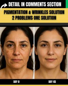 PIGMENTATION & WRINKLES SOLUTION: 2 PROBLEMS, 1 SIMPLE REMEDY (BY SKIN TYPE)