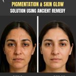 PIGMENTATION & SKIN GLOW SOLUTION USING ANCIENT REMEDY