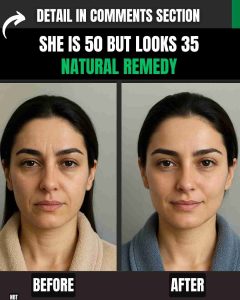 She Is 50 but Looks 35 – Natural Remedy with Diet Plan and Exercise