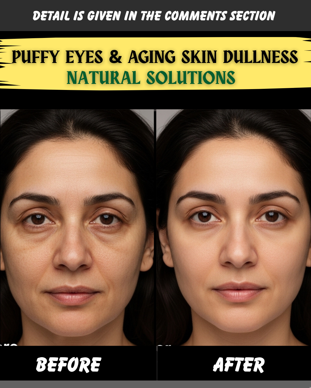 Puffy Eyes & Aging Skin Dullness: Natural Remedies by Skin Type