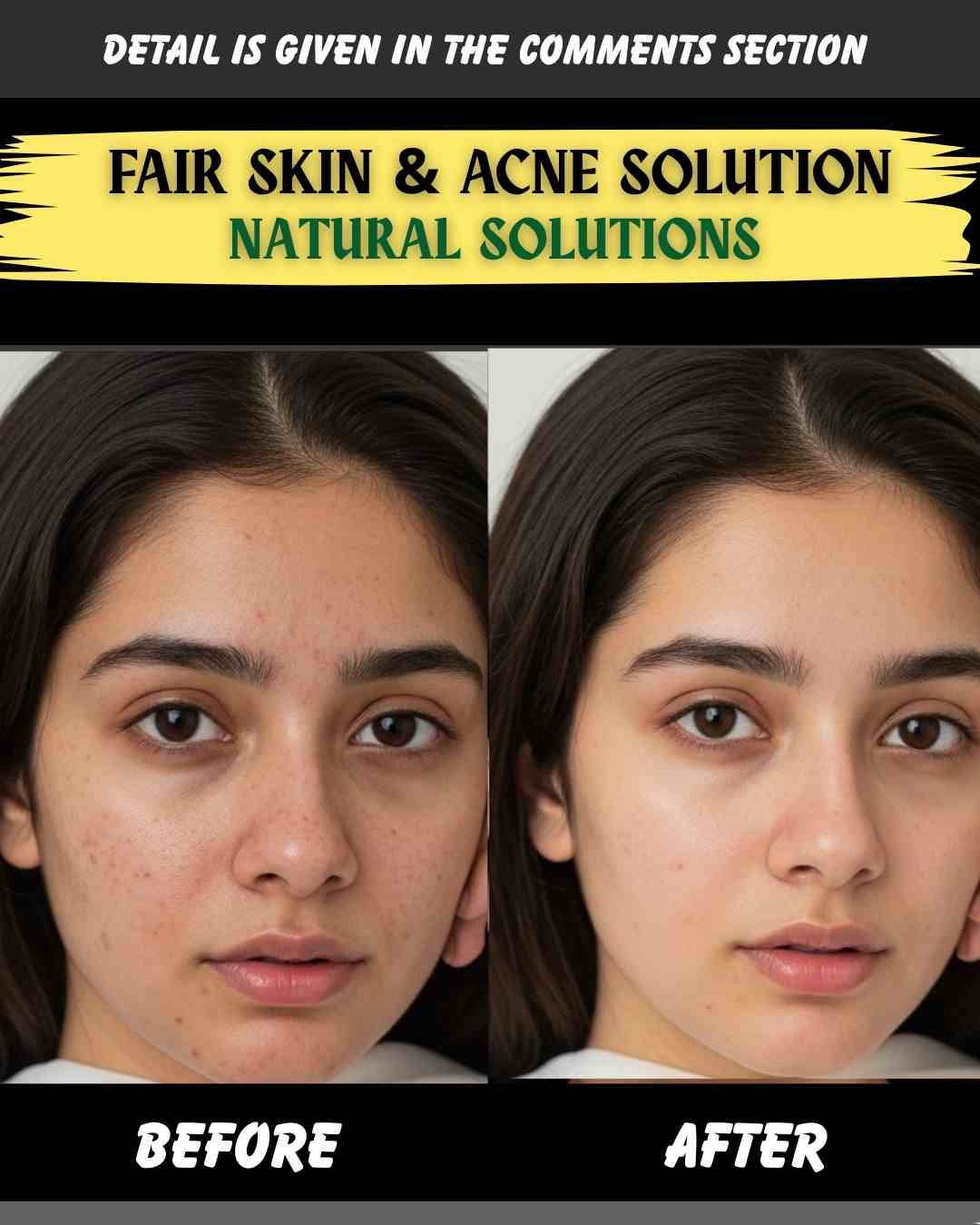 Fair Skin & Acne Solution: Natural Remedies by Skin Type
