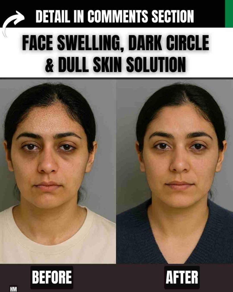 Face Swelling, Dark Circle & Dull Skin Solution
