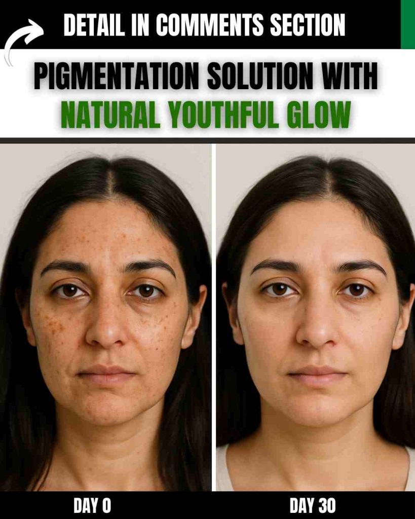 Pigmentation Solution with Natural Youthful Glow