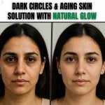 Dark Circles Remedy & Get Instant Natural Glow