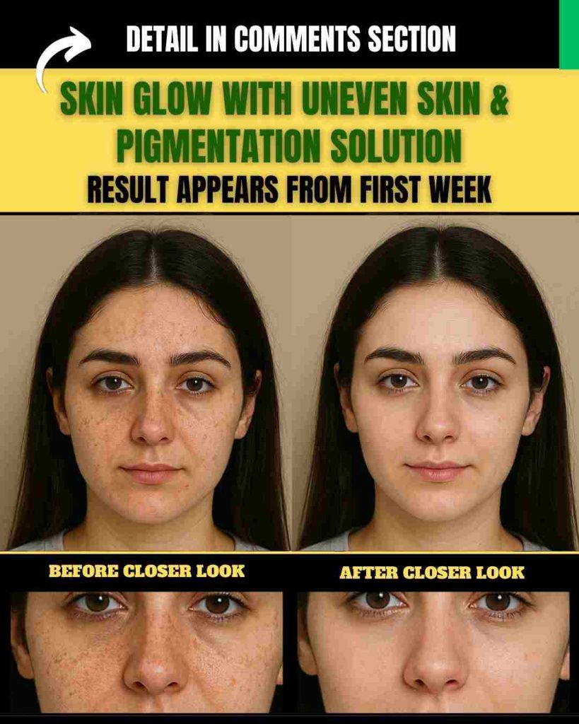 SKIN GLOW WITH UNEVEN SKIN AND PIGMENTATION SOLUTION