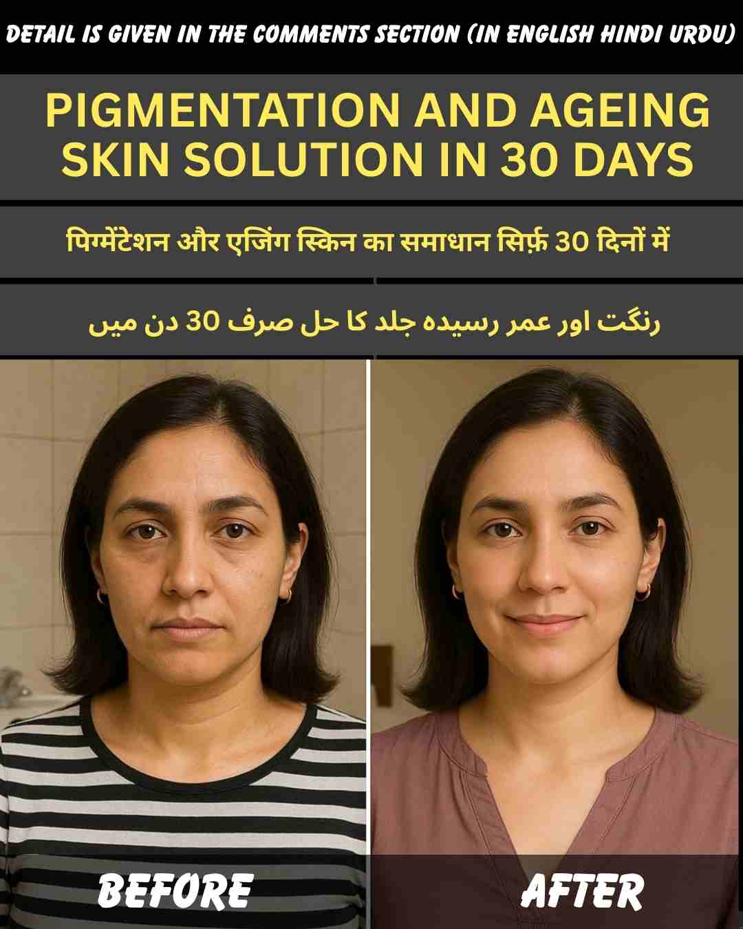 Pigmentation and Ageing Skin Solution in 30 Days