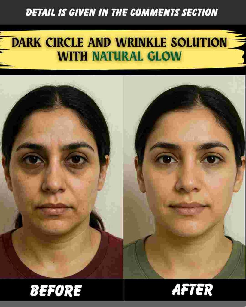 Dark Circle and Wrinkle Solution with Natural Glow