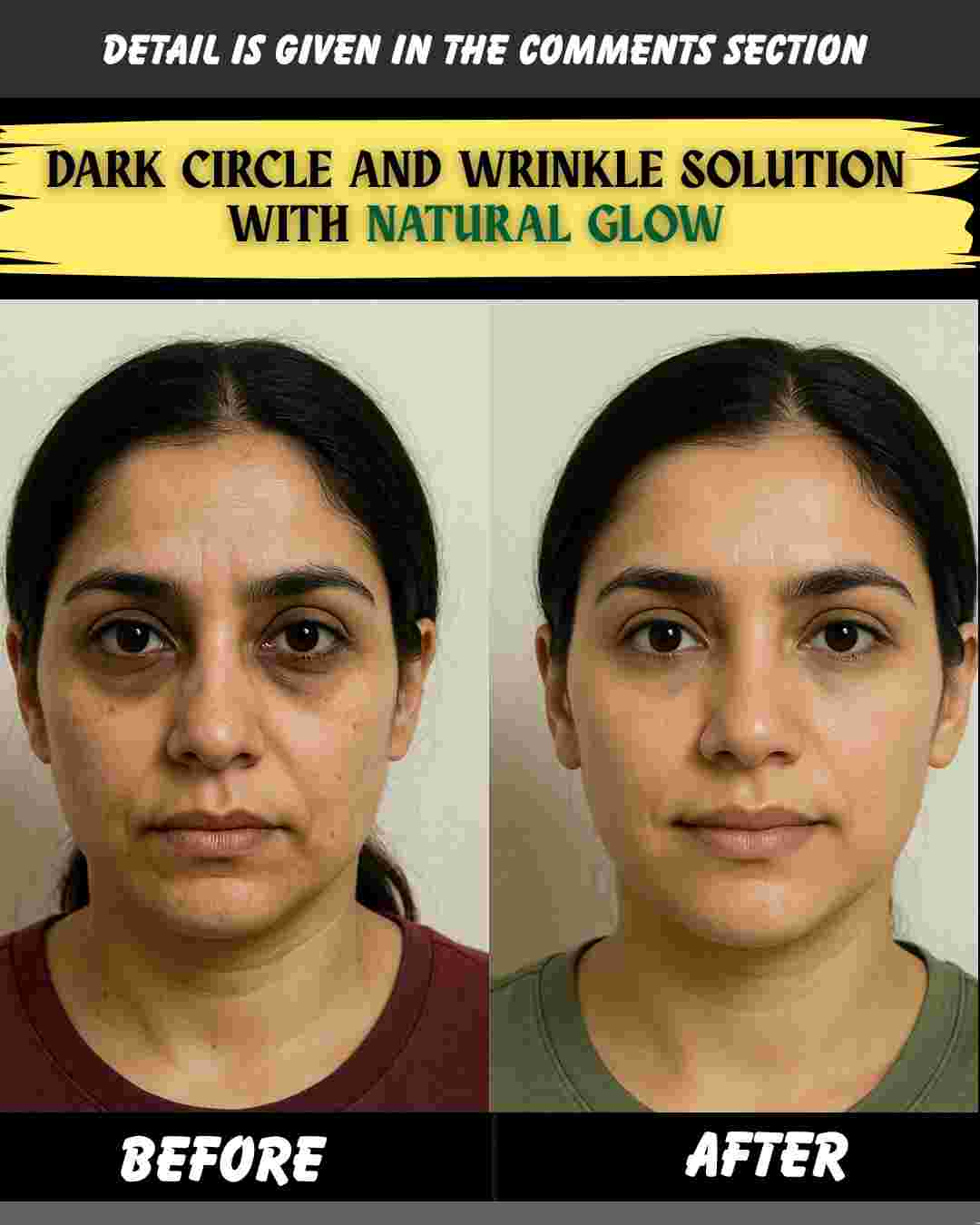 Dark Circle and Wrinkle Solution with Natural Glow