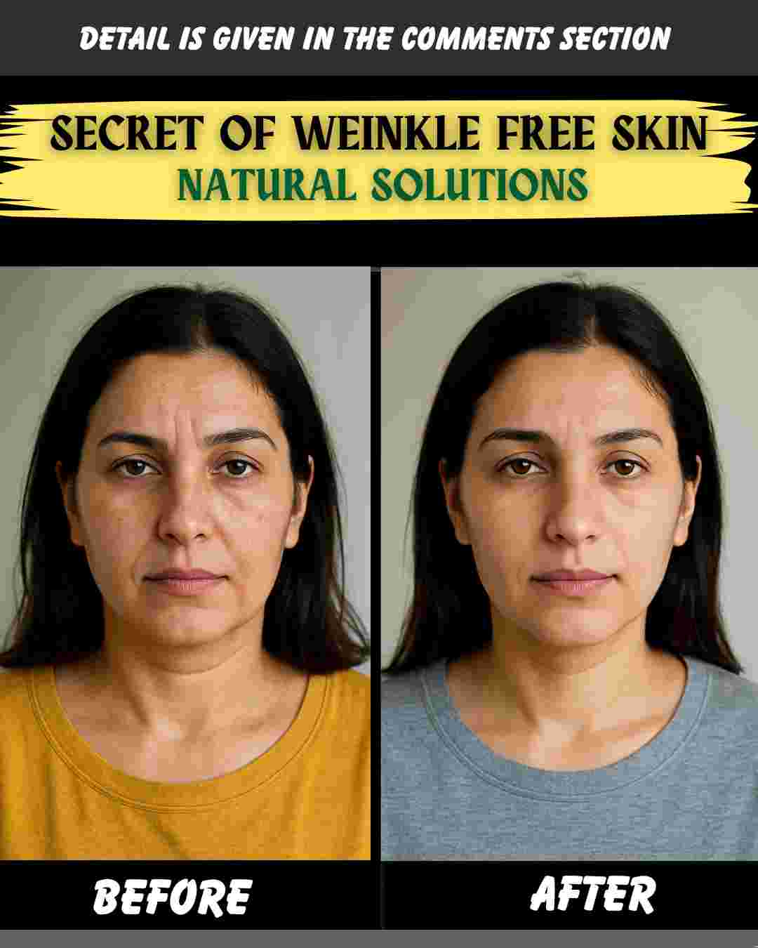 Secret of Wrinkle-Free Skin