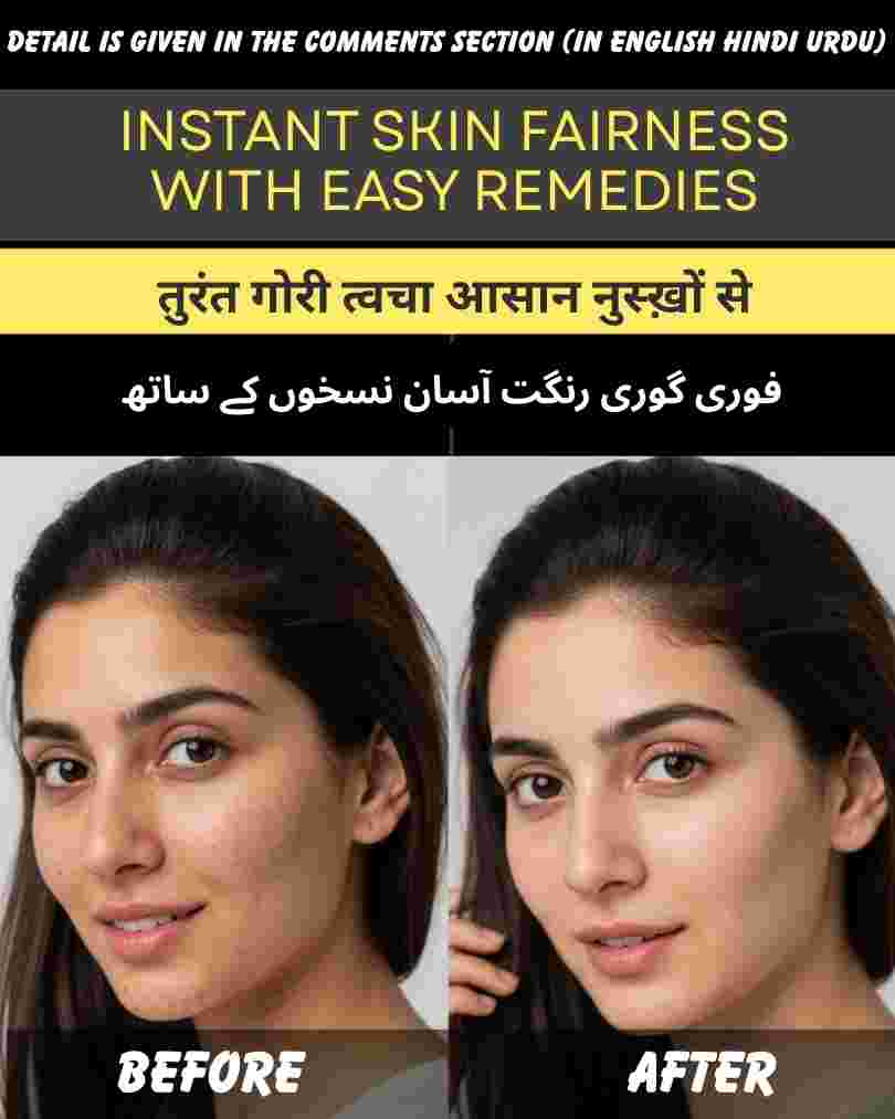 INSTANT SKIN FAIRNESS WITH EASY REMEDIES